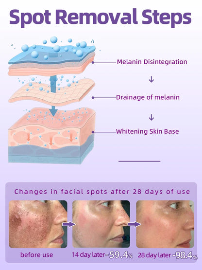 Freckles and Melasma Remover