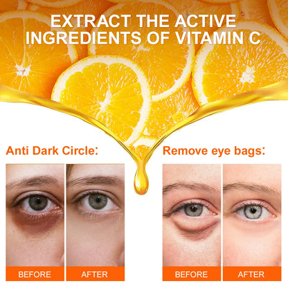 Anti Dark Circle Eye Cream