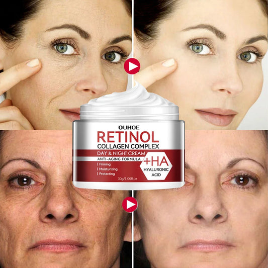 Retinol Face Lifting and Anti-Aging Cream