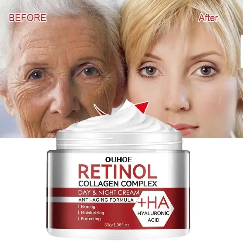 Retinol Face Lifting and Anti-Aging Cream